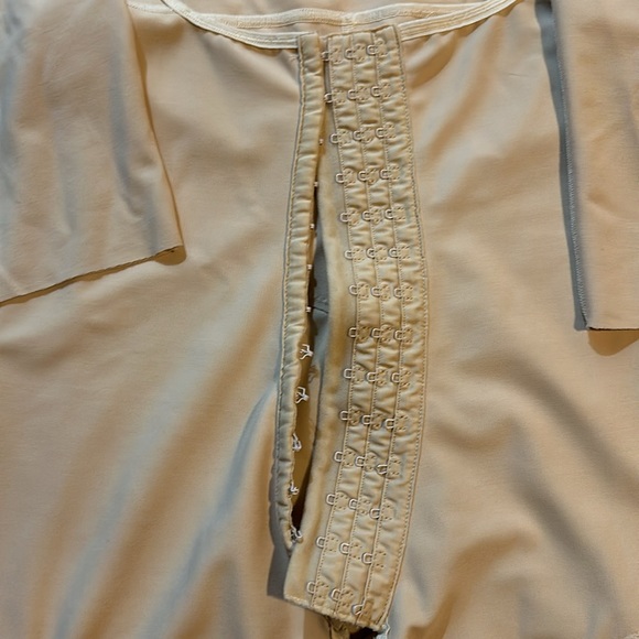 Marena post op stage 1 faja - Picture 3 of 5